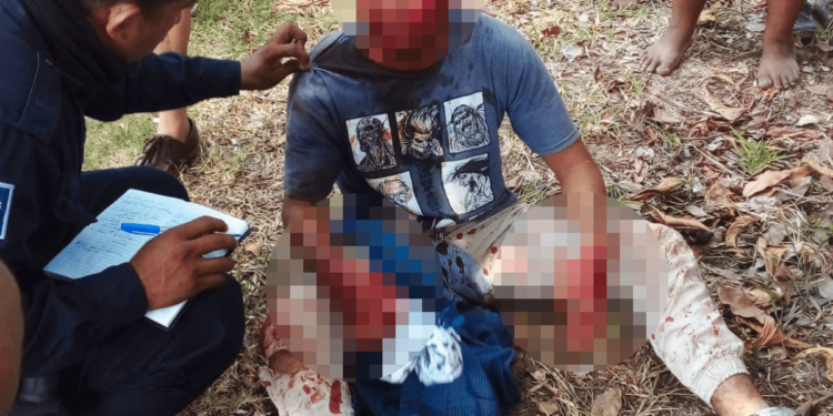 Terminó pelado como bacinica