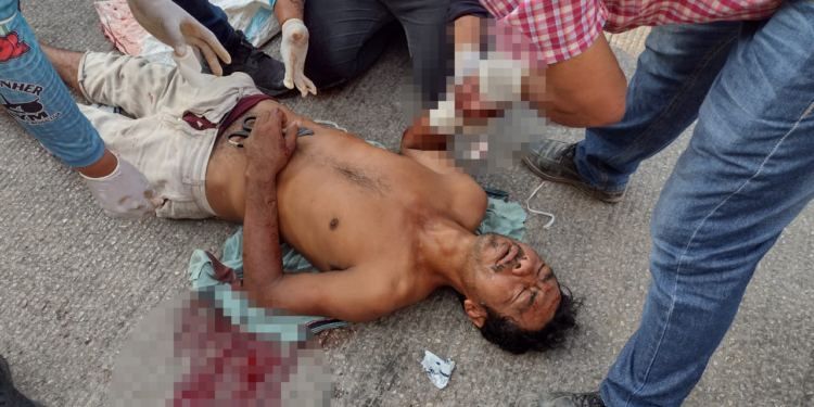 Le cercenaron la mano