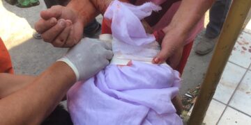 Inexperto motociclista