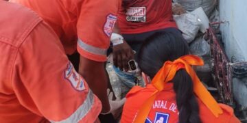 Se chamuscó la mano