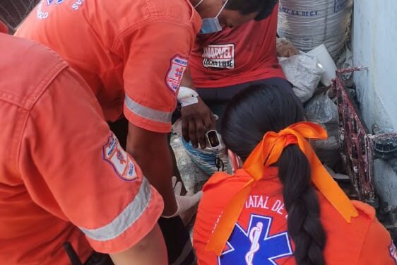 Se chamuscó la mano