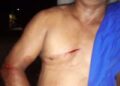 Agredido a machetazos
