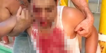 Se desbarató la cara