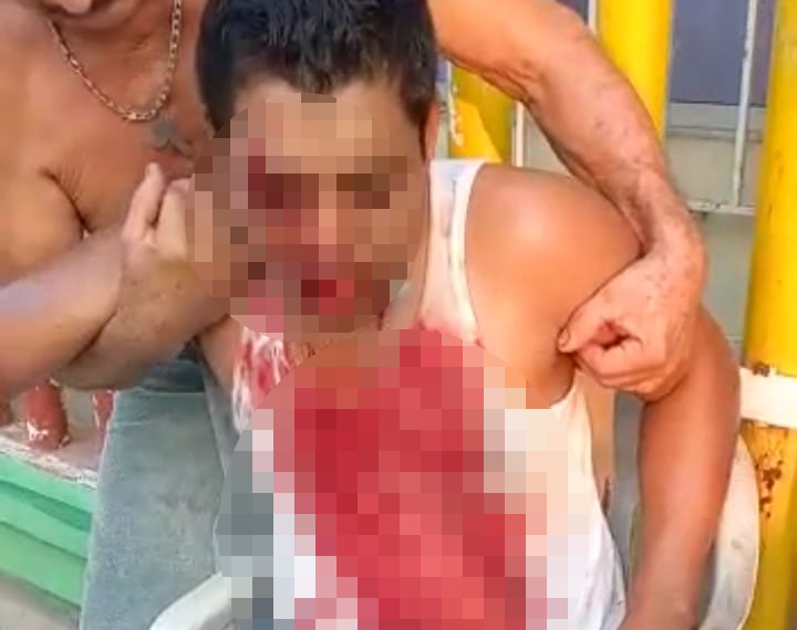 Se desbarató la cara