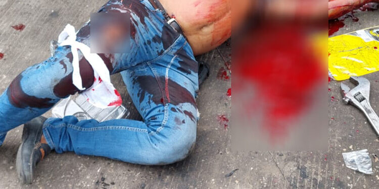 Motociclista acribillado