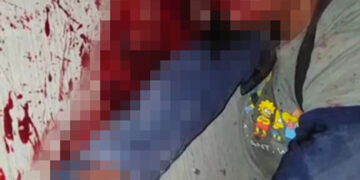 Lo dejaron como santo Cristo