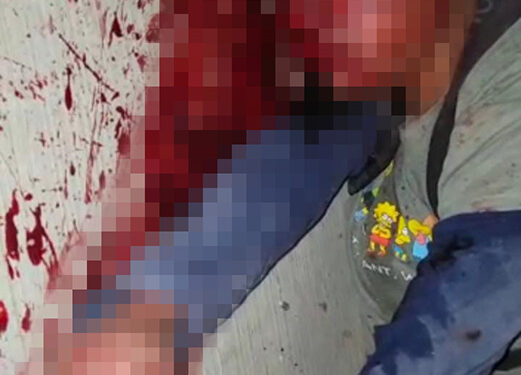 Lo dejaron como santo Cristo