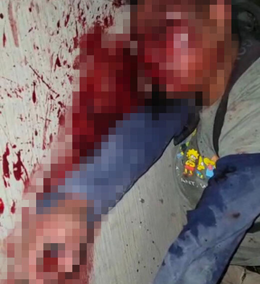 Lo dejaron como santo Cristo