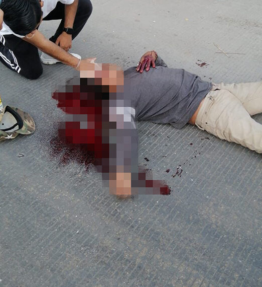 Tunden a sujeto a golpes y queda en charco de sangre