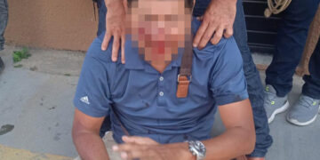 Un tres toneladas lo dejo “bembo