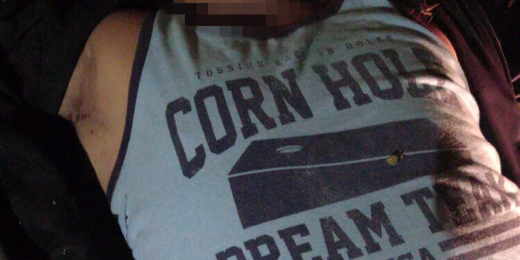 Le volaron los sesos