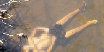 Le partieron el corazón