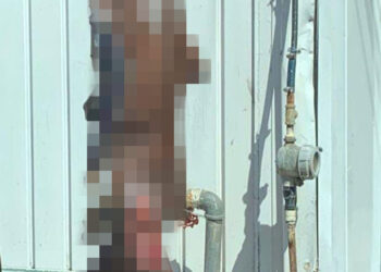 Infierno en la tierra para joven quemado