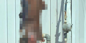 Infierno en la tierra para joven quemado