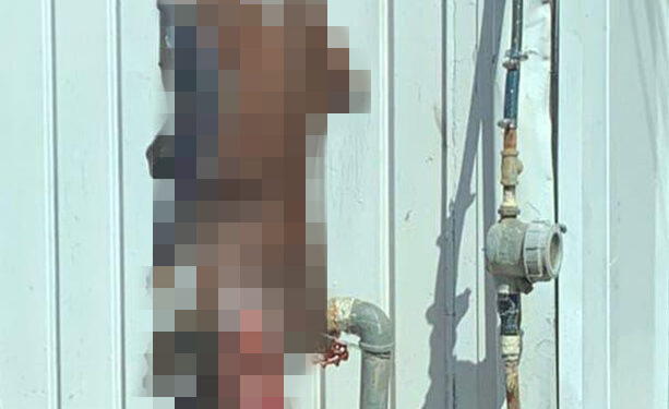 Infierno en la tierra para joven quemado