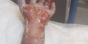 Investigan a chacales