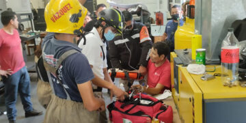 Casi le mocha la mano