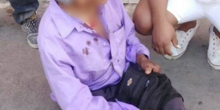 Caballo de acero golpea a abuelito