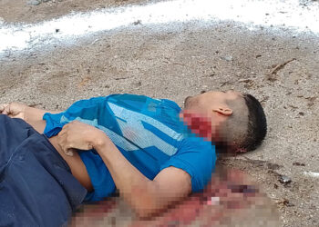 Machetazo en el cuello