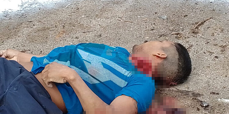 Machetazo en el cuello