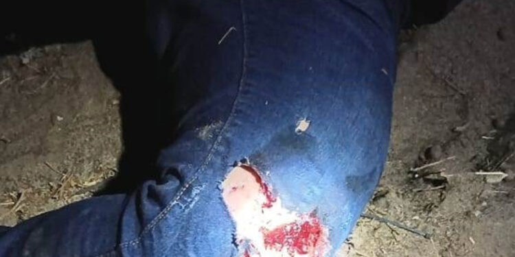 Se despedazó la rodilla