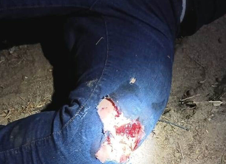 Se despedazó la rodilla