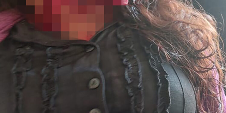 Le desfiguraron el rostro