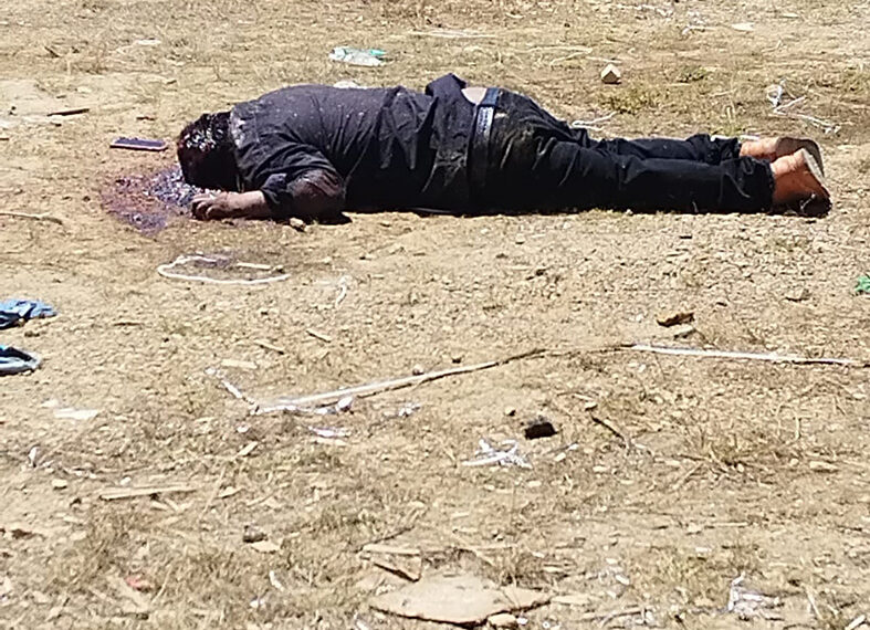 Le dieron un tiro en la cabeza