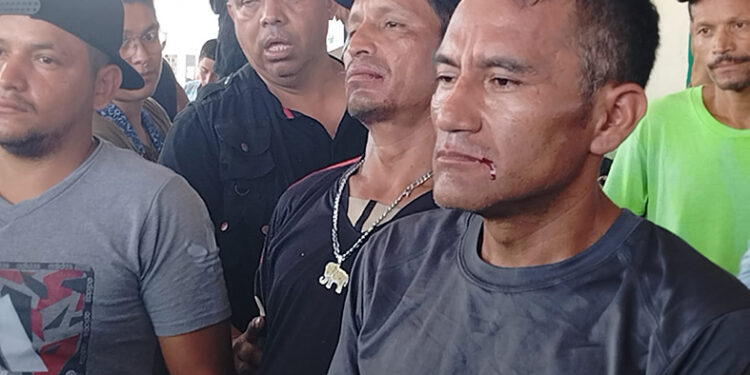 Se suturan los labios otros cinco