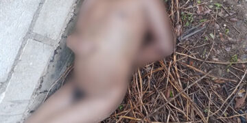 Torturado y sin ropa