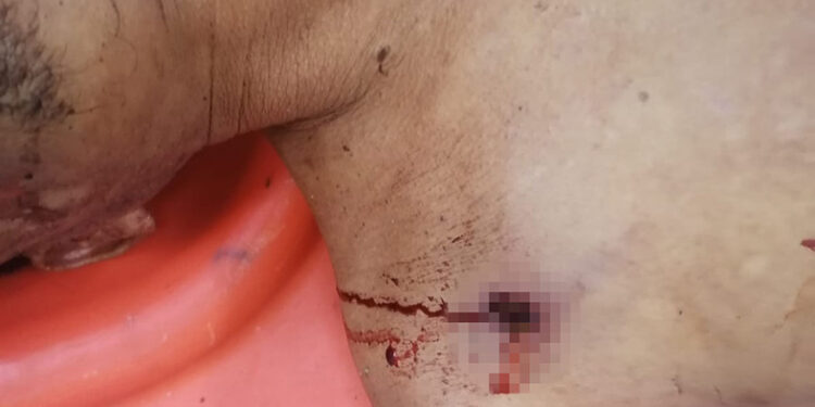 Falleció tras recibir dos balazos