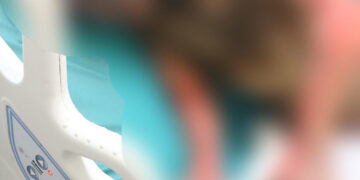 ¡Quemó a su esposa!