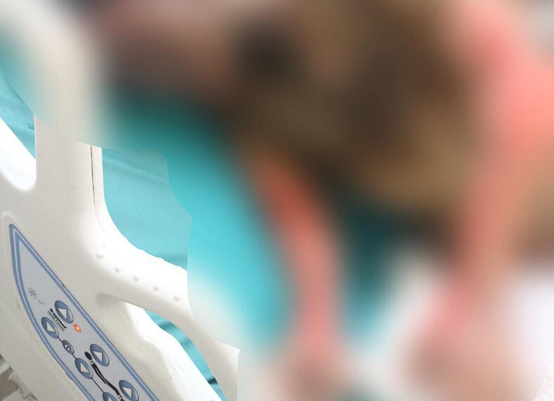 ¡Quemó a su esposa!