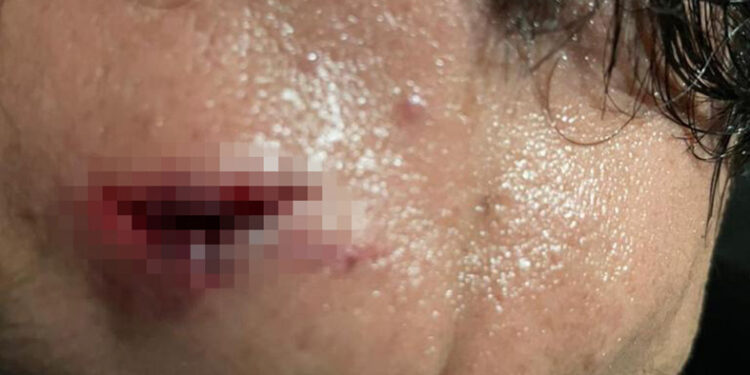 Dejan a “poli”como alcancía