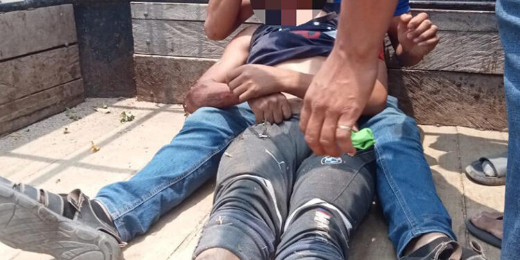 Joven grave tras derrapón