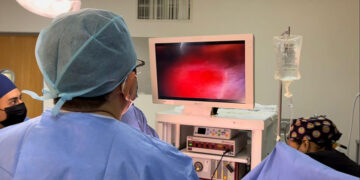 Primer estado en aplicar técnica para vesícula biliar