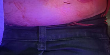 Lo “poncharon” de un navajazo