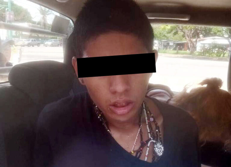 Cae par de “ratas colas peludas”