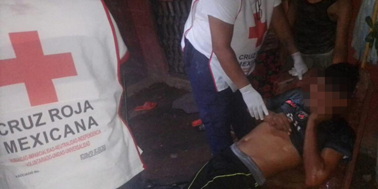 Le dan un tiro en la cabeza y ¡vive!