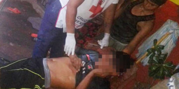 Recibió un tiro en la cabeza