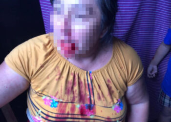 Golpean a viejito y dos mujeres