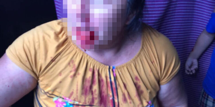 Golpean a viejito y dos mujeres