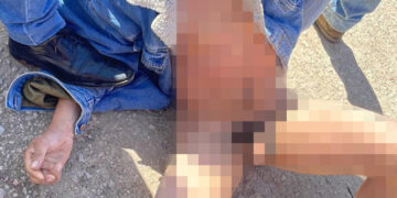 Por rata fue golpeado