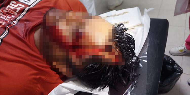 Dos “jinetes” graves