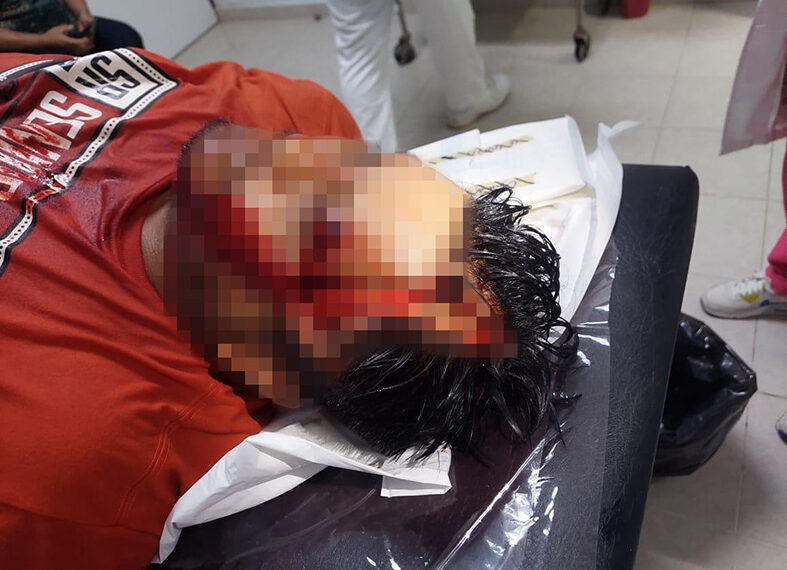 Dos “jinetes” graves