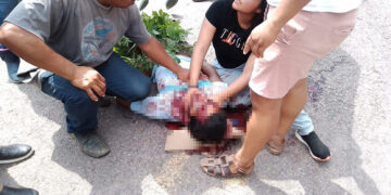 No logró sobrevivir