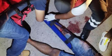 Acaba con la “pata tronchada”