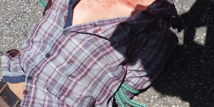 Lo dejaron “guapo” a cachetazos