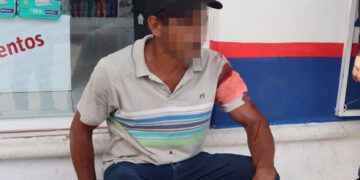 Lo iban a dejar tunco