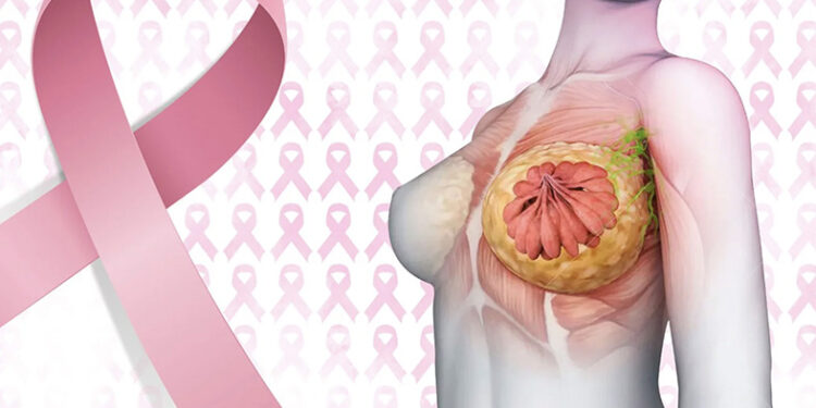 COLABORACIÓN INVITADA